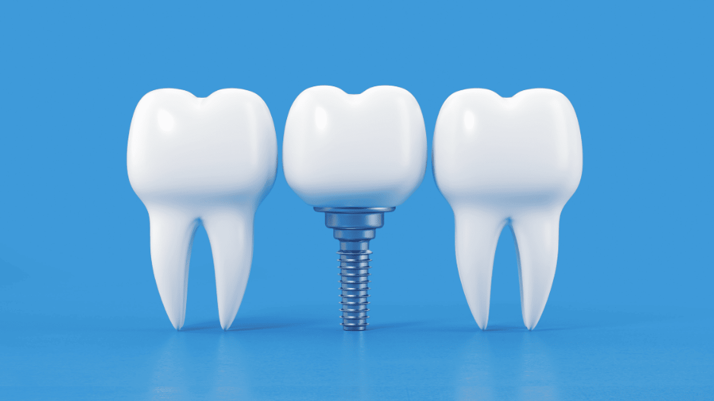 FDA Guidance on Endosseous Dental Implants: Overview